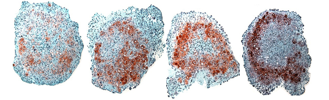 Chondrogenic differentiation assay