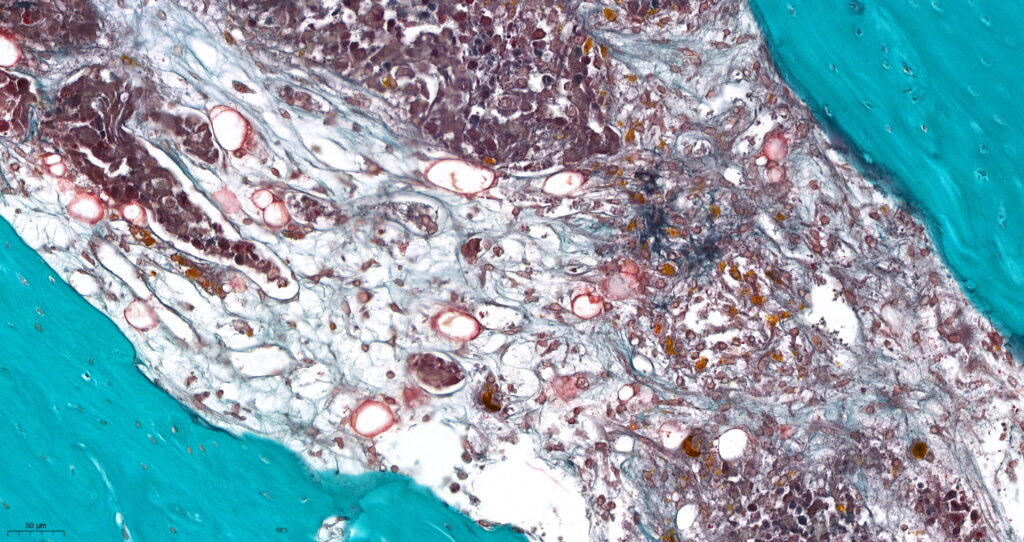 In vitro cancer cell-based assays